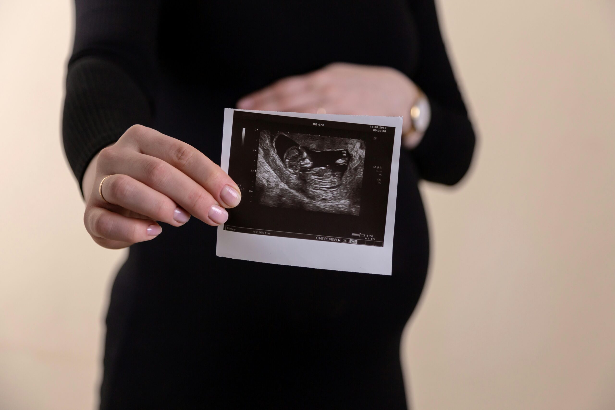 How Ultrasound Monitoring Brings You Closer to Understanding Your Fertility Health